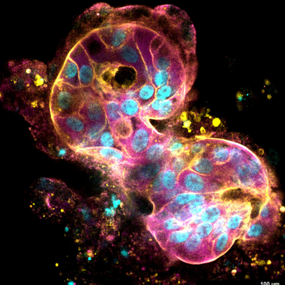 CytoGrow supports organoid culture