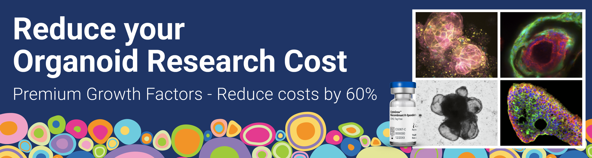 Looking to reduce your organoid culture cost? Introducting CytoGrow™ Growth Factors Recombinant Protein